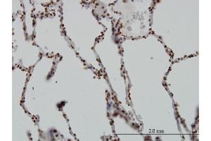Immunoperoxidase of monoclonal antibody to SGK on formalin-fixed paraffin-embedded human lung. (SGK1 抗体  (AA 1-90))