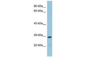 NAT8B antibody used at 1 ug/ml to detect target protein. (NAT8B 抗体)