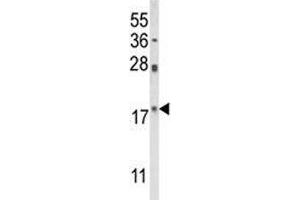 Western blot analysis of PIN1 antibody and HL-60 lysate (PIN1 抗体  (AA 30-56))