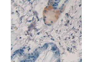 Used in DAB staining on fromalin fixed paraffin- embedded Kidney tissue (Keratin 2 抗体  (AA 200-508))