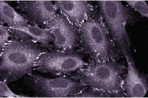 Immunofluorescent staining of EAHY human endothelial cells. (TJP1 抗体  (AA 1048-1247))