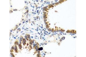 Immunohistochemistry of paraffin-embedded Rat lung using C8orf4 Polyclonal Antibody at dilution of 1:100 (40x lens). (C8orf4 抗体)