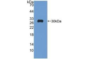Detection of Recombinant GR, Rat using Polyclonal Antibody to Glutathione Reductase (GR) (Glutathione Reductase 抗体  (AA 7-246))