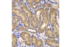 Immunohistochemistry (Paraffin-embedded Sections) (IHC (p)) image for anti-Nucleoside diphosphate kinase B (NME2) (AA 1-152) antibody (ABIN6144678)