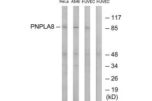 Western blot analysis of extracts from HeLa cells, A549 cells and HUVEC cells, using PNPLA8 antibody. (PNPLA8 抗体  (C-Term))