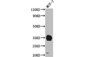 Western Blot Positive WB detected in: MCF-7 whole cell lysate All lanes: IGFBP2 antibody at 1:1000 Secondary Goat polyclonal to rabbit IgG at 1/50000 dilution Predicted band size: 35 kDa Observed band size: 35 kDa (Recombinant IGFBP2 抗体)