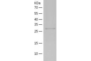 Western Blotting (WB) image for Zinc Finger CCCH-Type Containing 12A (ZC3H12A) (AA 348-599) protein (His tag) (ABIN7122779)
