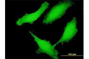 Immunofluorescence of purified MaxPab antibody to CCDC115 on HeLa cell. (CCDC115 抗体  (AA 1-180))