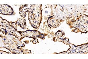 Detection of LIFR in Human Placenta Tissue using Polyclonal Antibody to Leukemia Inhibitory Factor Receptor (LIFR) (LIFR 抗体  (AA 522-691))