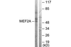 Western blot analysis of extracts from HeLa cells, treated with PMA 125ng/ml 30', using MEF2A (Ab-408) Antibody. (MEF2A 抗体  (AA 374-423))