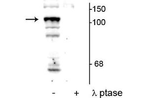 Western blot of mouse testicular lysate showing specific immunolabeling of the ~104 kDa PTPH1 phosphorylated at Ser459 in the first lane (-). (PTPN3 抗体  (pSer459))