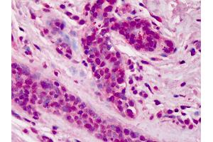 Anti-DOK1 antibody IHC of human breast.