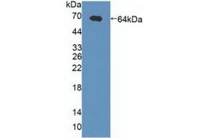 Detection of Recombinant gABRa2, Human using Polyclonal Antibody to Gamma-Aminobutyric Acid A Receptor Alpha 2 (gABRa2) (GABRA2 抗体  (AA 42-250))