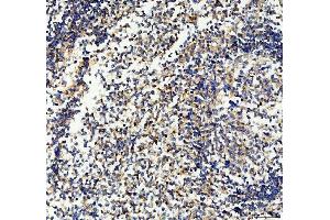 IHC analysis of CD33 using anti-CD33 antibody (ABIN4886523). (CD33 抗体  (AA 18-259))