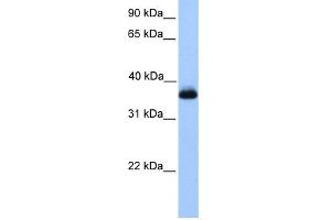 WB Suggested Anti-ERI2 Antibody Titration: 0. (ERI2 抗体  (Middle Region))