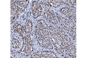 IHC analysis of Lamin A+C/LMNA using anti-Lamin A+C/LMNA antibody (ABIN7601843). (Lamin A/C 抗体  (AA 481-646))