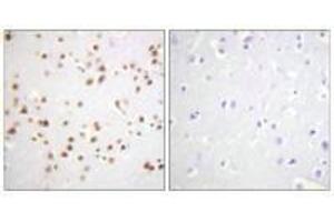 Immunohistochemistry analysis of paraffin-embedded human brain tissue using Catenin-δ1 (Ab-228) antibody. (CTNND1 抗体  (Tyr228))