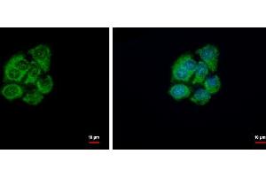 ICC/IF Image GSTZ1 antibody [N1C3] detects GSTZ1 protein at cytoplasm by immunofluorescent analysis. (GSTZ1 抗体)