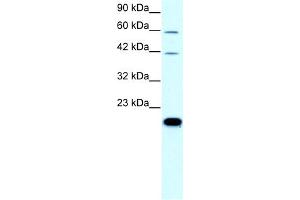 WB Suggested Anti-CLDN23 Antibody Titration:  0. (Claudin 23 抗体  (C-Term))
