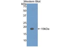 Western Blotting (WB) image for anti-Interleukin 12 Receptor, beta 2 (IL12RB2) (AA 285-441) antibody (ABIN3207280) (IL12RB2 抗体  (AA 285-441))