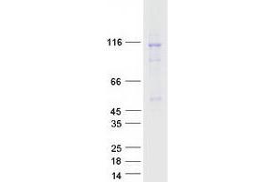 Western Blotting (WB) image for Cullin 4B (CUL4B) (Transcript Variant 1) protein (Myc-DYKDDDDK Tag) (ABIN2712633)