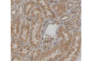 Immunohistochemistry (IHC) image for anti-Heat Shock 27kDa Protein 1 (HSPB1) (pSer15) antibody (ABIN6256149)