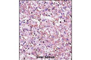 IGF1 Antibody (C-term) (ABIN658020 and ABIN2837861) immunohistochemistry analysis in formalin fixed and paraffin embedded human liver tissue followed by peroxidase conjugation of the secondary antibody and DAB staining. (IGF1 抗体  (C-Term))