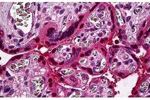 Human Placenta: Formalin-Fixed, Paraffin-Embedded (FFPE) (STAT5B 抗体  (AA 678-788))