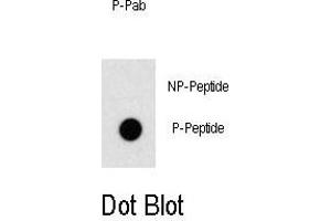 Dot blot analysis of anti-Phospho-OSR1-p Antibody Antibody (ABIN389959 and ABIN2839760) on nitrocellulose membrane. (OSR1 抗体  (pThr310))