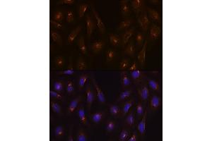 Immunofluorescence (IF) image for anti-Clathrin Heavy Chain (CLTC) antibody (ABIN7266404)