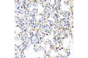 Immunohistochemistry of paraffin-embedded rat lung using TIRAP Rabbit mAb (ABIN7270842) at dilution of 1:100 (40x lens). (TIRAP 抗体)