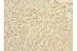 Immunohistochemistry of paraffin-embedded human adrenal gland tissue using ABIN7174780 at dilution of 1:100 (C1ORF127 抗体  (AA 401-648))