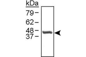Detection of Ctse in 10 ug of murine reticulocyte lysate using Ctse polyclonal antibody . (Cathepsin E 抗体)