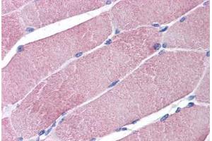 Human Skeletal Muscle: Formalin-Fixed, Paraffin-Embedded (FFPE) (TRIM7 抗体  (AA 209-221))