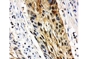 Immunohistochemistry (IHC) image for anti-Stratifin (SFN) (AA 140-156) antibody (ABIN3032756)