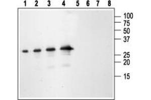 Western blot analysis of mouse recombinant pro:1,5.