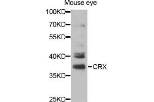 Western blot analysis of extracts of Mouse eye cell line, using CRX antibody. (CRX 抗体)