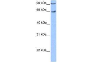 Western Blotting (WB) image for anti-Zinc Finger Protein 449 (ZNF449) antibody (ABIN2460405) (ZNF449 抗体)