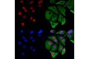 ABIN6263417 and ABIN6272965 staining Hela cells by IF/ICC. (MTA3 抗体  (Internal Region))