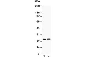 Western blot testing of Claudin 2 antibody and Lane 1:  rat kidney;  2: rat liver (Claudin 2 抗体  (AA 38-230))