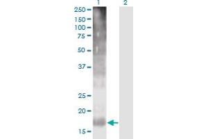 Western Blot analysis of TM4SF4 expression in transfected 293T cell line by TM4SF4 monoclonal antibody (M03), clone 4E6. (TM4SF4 抗体  (AA 1-202))