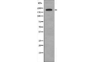 Western blot analysis of extracts from COLO cells, using BCOR antibody. (BCOR 抗体  (Internal Region))