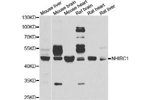 Western blot analysis of extracts of various cell lines, using NHLRC1 antibody. (NHLRC1 抗体)