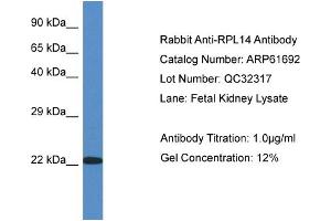 Western Blotting (WB) image for anti-Ribosomal Protein L14 (RPL14) (C-Term) antibody (ABIN2788870) (RPL14 抗体  (C-Term))