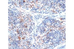 Immunohistochemistry of paraffin-embedded Rat spleen using SLAMF7 Polyclonal Antibody at dilution of 1:100 (40x lens). (SLAMF7 抗体)