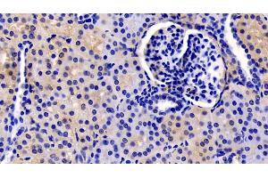 Detection of TSLP in Human Kidney Tissue using Monoclonal Antibody to Thymic Stromal Lymphopoietin (TSLP) (Thymic Stromal Lymphopoietin 抗体  (AA 29-159))