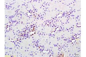Formalin-fixed and paraffin embedded rat kidney tissue labeled with Anti phospho-MAP3K9+MAP3K10(Thr312+Thr266) Polyclonal Antibody, Unconjugated  at 1:200 followed by conjugation to the secondary antibody and DAB staining (MAP3K9 抗体  (pThr312))