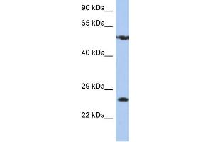 WB Suggested Anti-ZNF10 Antibody Titration:  0. (ZNF10 抗体  (N-Term))