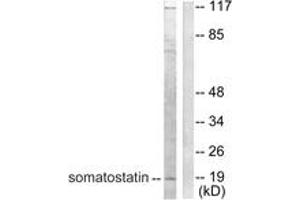 Western blot analysis of extracts from A549 cells, using Somatostatin Antibody. (Somatostatin 抗体  (AA 10-59))