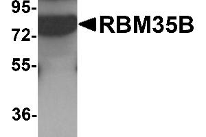 Western blot analysis of RBM35B in human lung tissue lysate with RBM35B antibody at 1 µg/mL. (ESRP2 抗体  (C-Term))